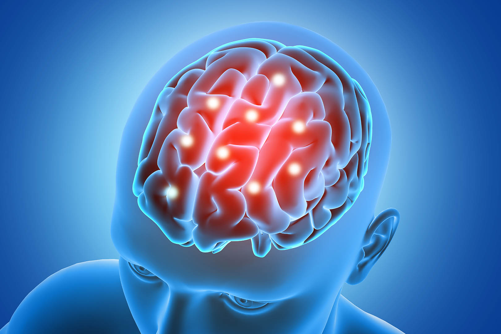 Penyakit Meningitis: Penyebab, Gejala, dan Faktor Risikonya