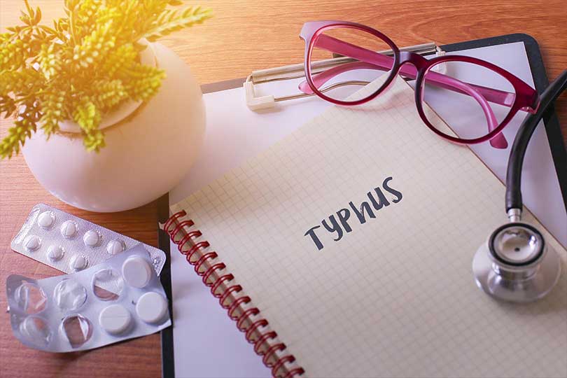 Demam Tifoid (Tipes)