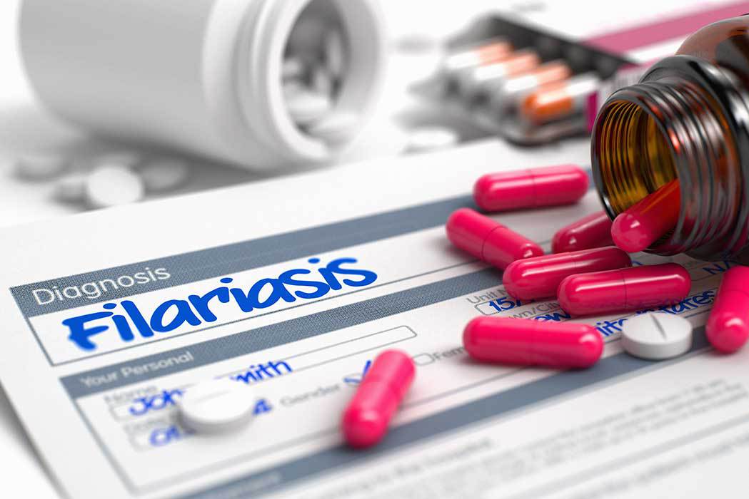 Filariasis
