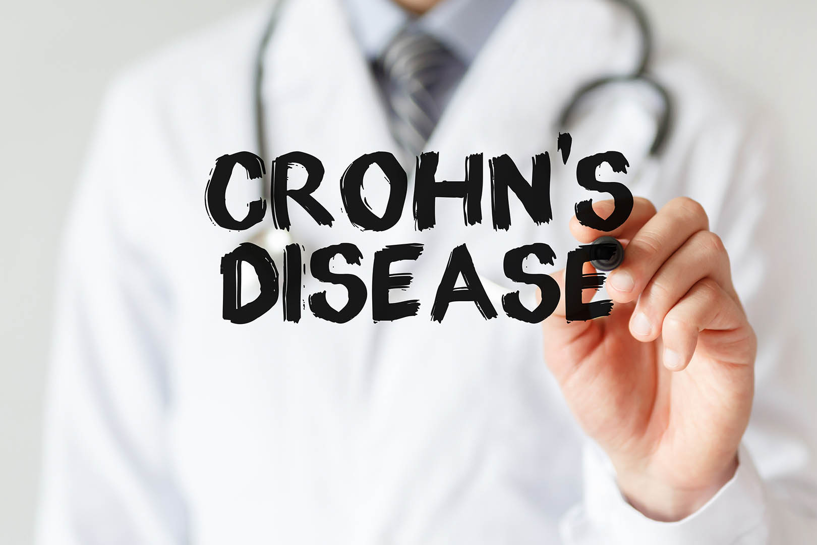 Crohn’s Disease (Penyakit Crohn)