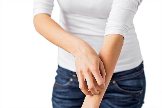 Fluprednidene Acetate