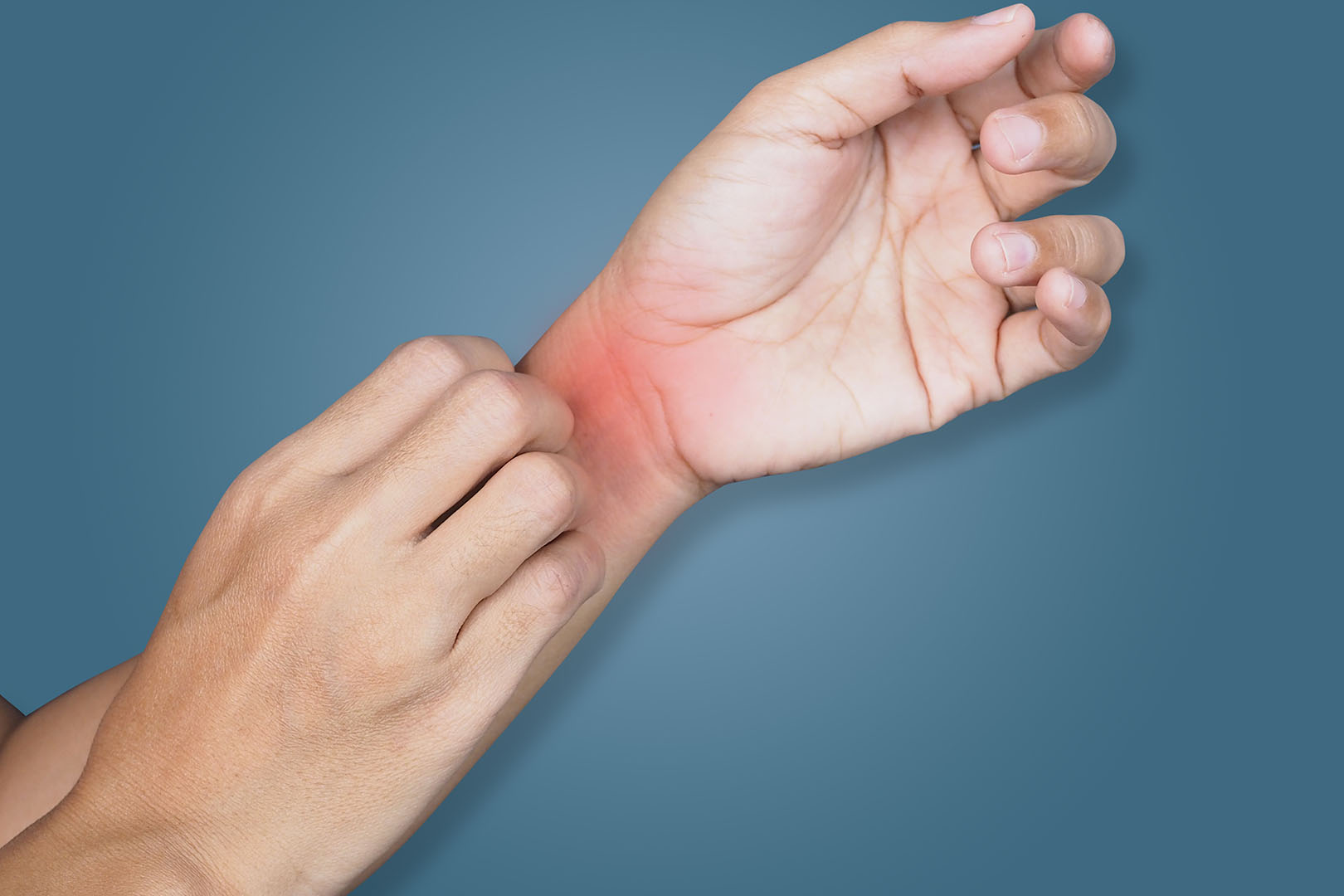 Kenacort, Obat Untuk Bantu Atasi Peradangan dan Alergi