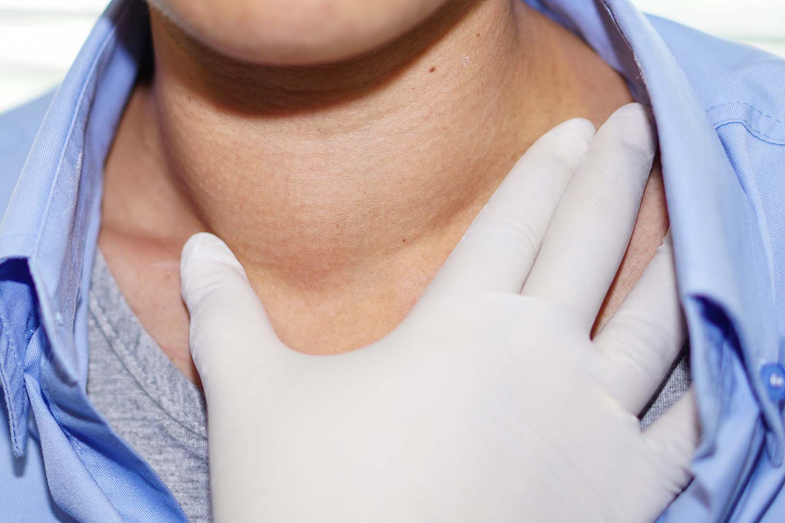 Kenali 5 Tanda Penyakit Lipoma dan Cara Mencegahnya