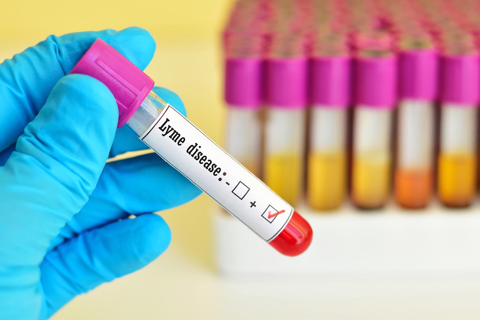 Penyakit Lyme, Penyakit yang Ditimbulkan Oleh Kutu