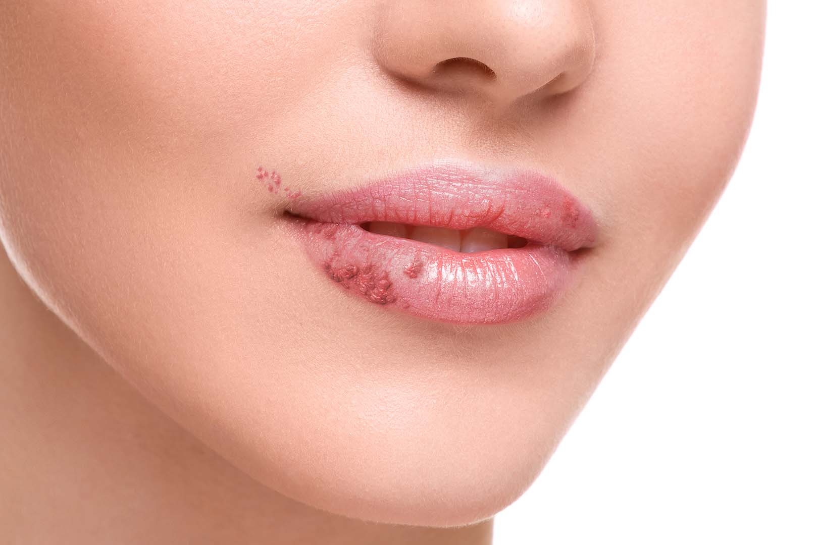 L-Lysine Monoacetate