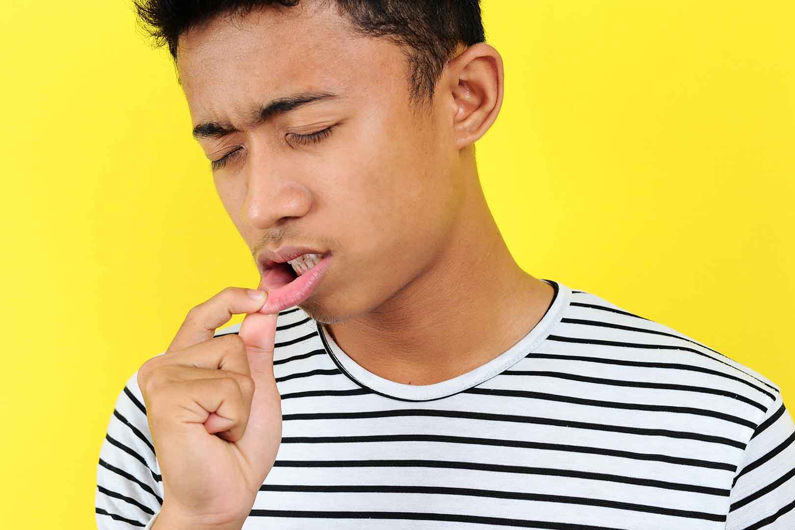 5 Cara Mudah Obati Sariawan