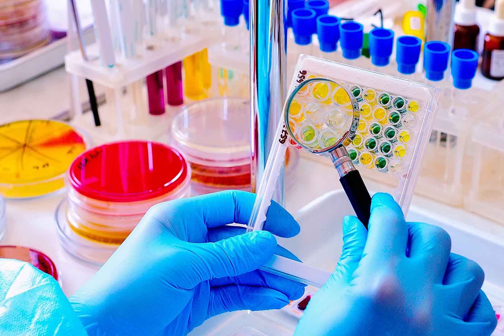 Biar Tidak Gagal Paham, Inilah Perbedaan antara Virus dan Bakteri!