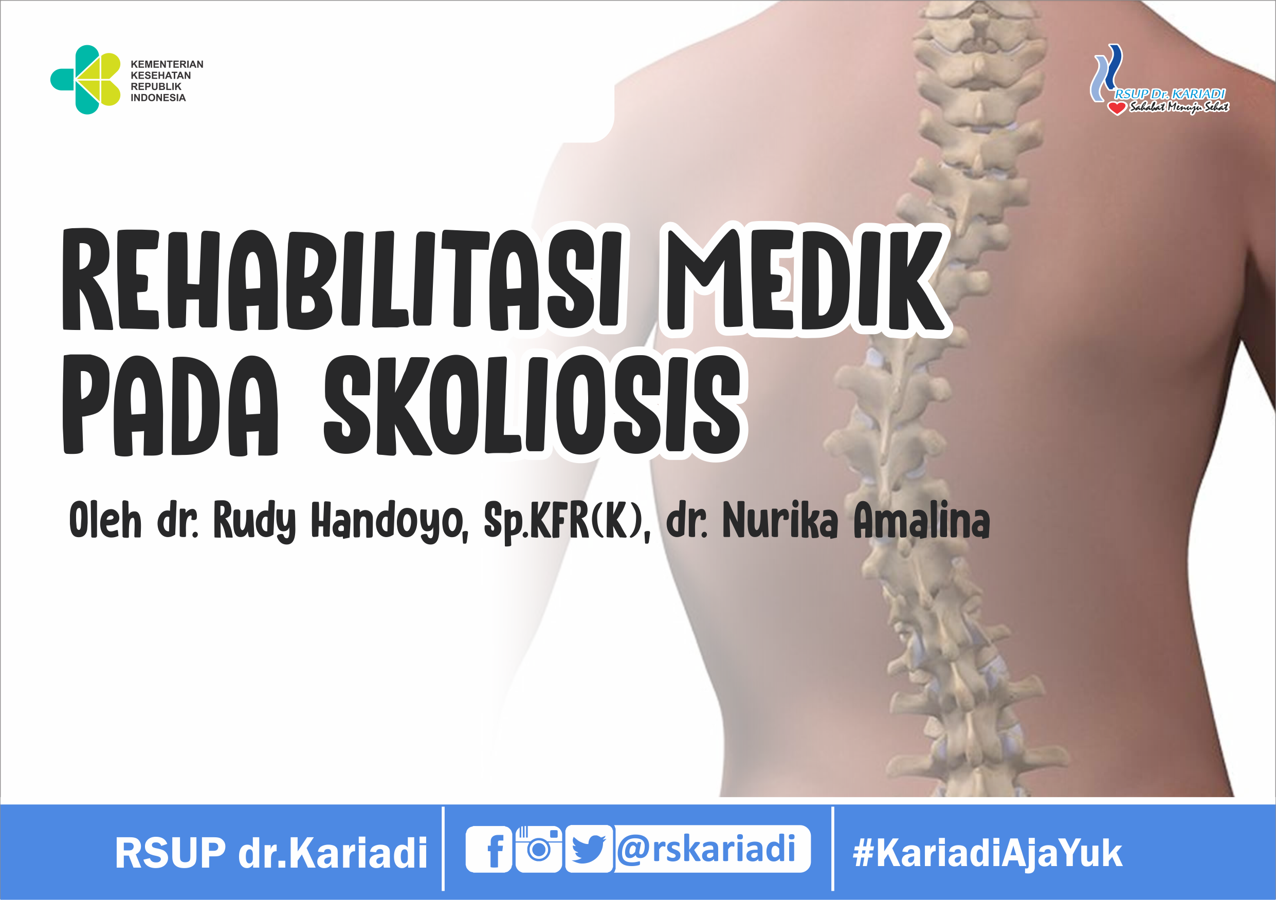 Mengenal Tentang Rehabilitasi Medik Pada Skoliosis