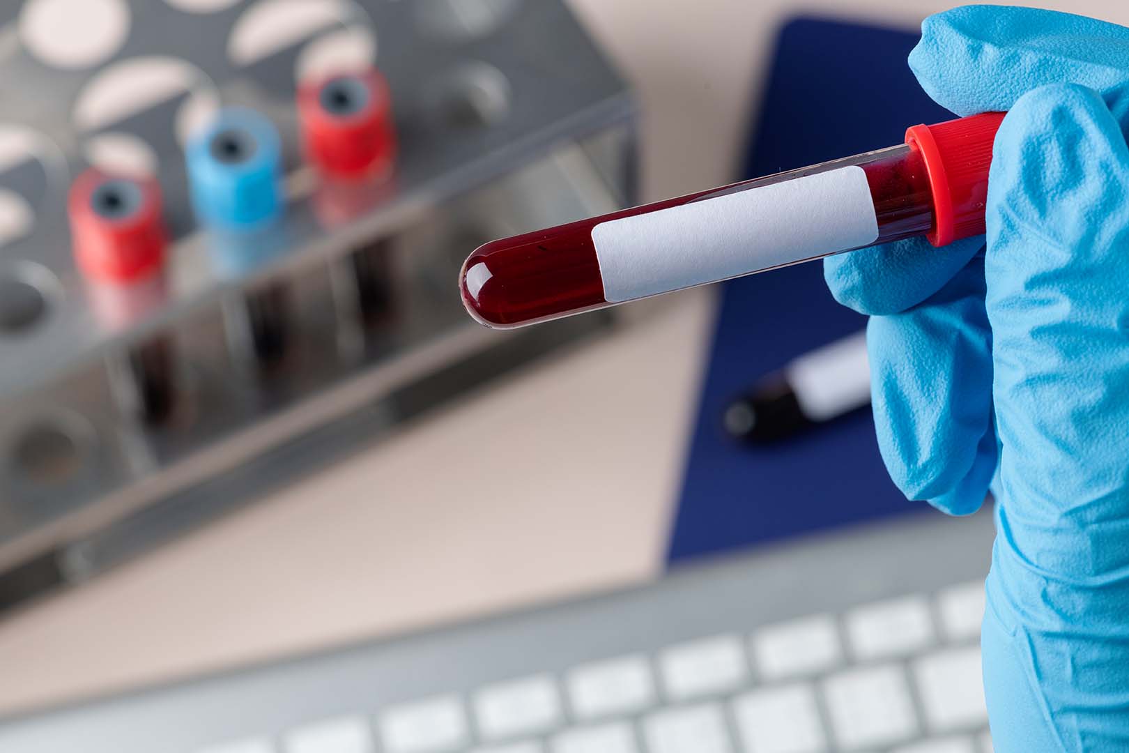 Mengenal Anemia Gravis, Penyakit Yang Dapat Menyebabkan Kematian