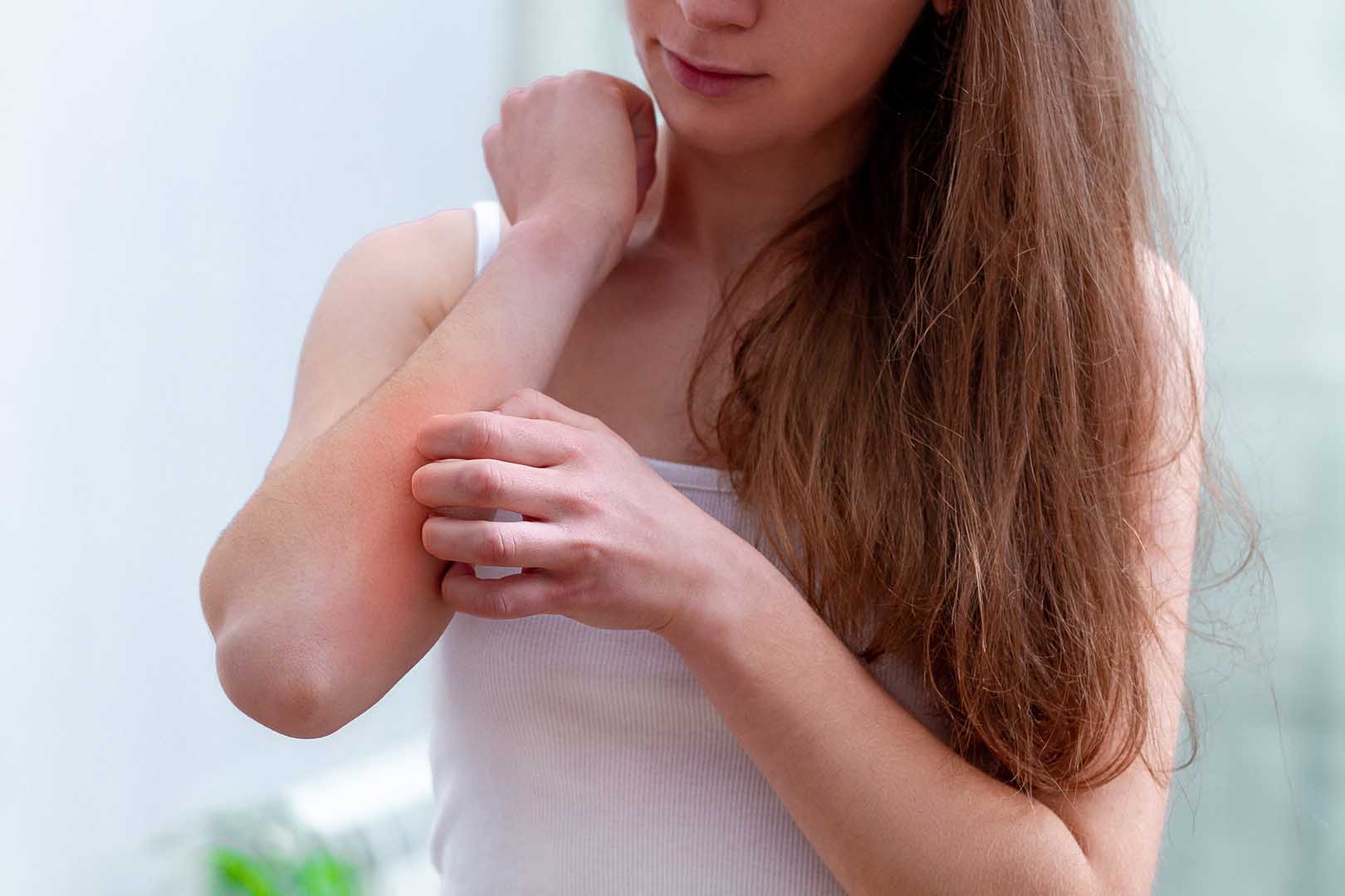 Klobetasol Propionat