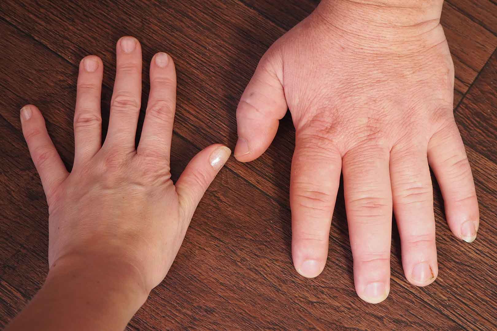 Mengenal Manfaat Obat Bromocriptine