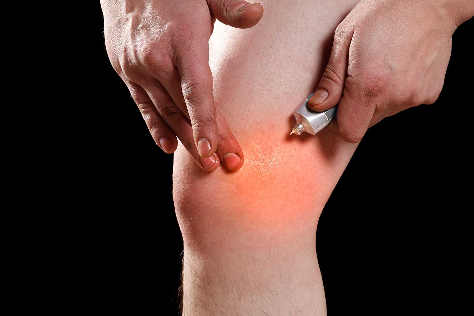 Mengenal Trombopop, Obat Penghilang Memar Pada Kulit