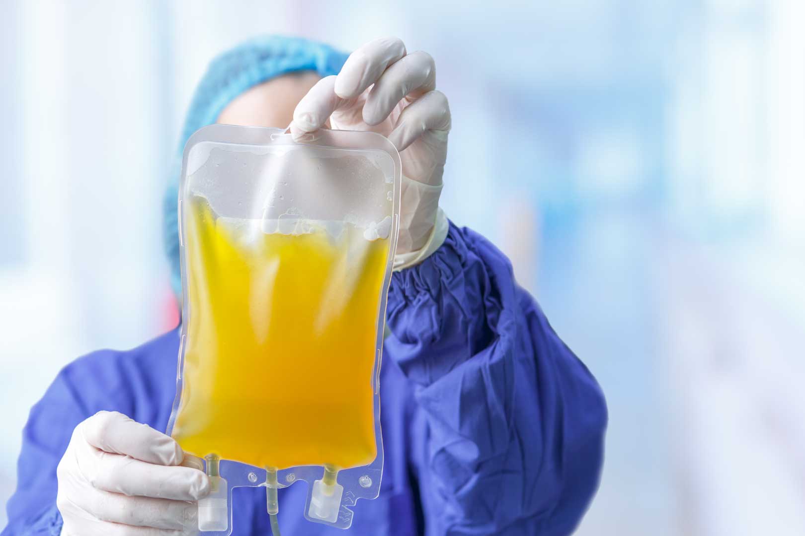 Terapi Plasma Konvalesen Untuk COVID-19