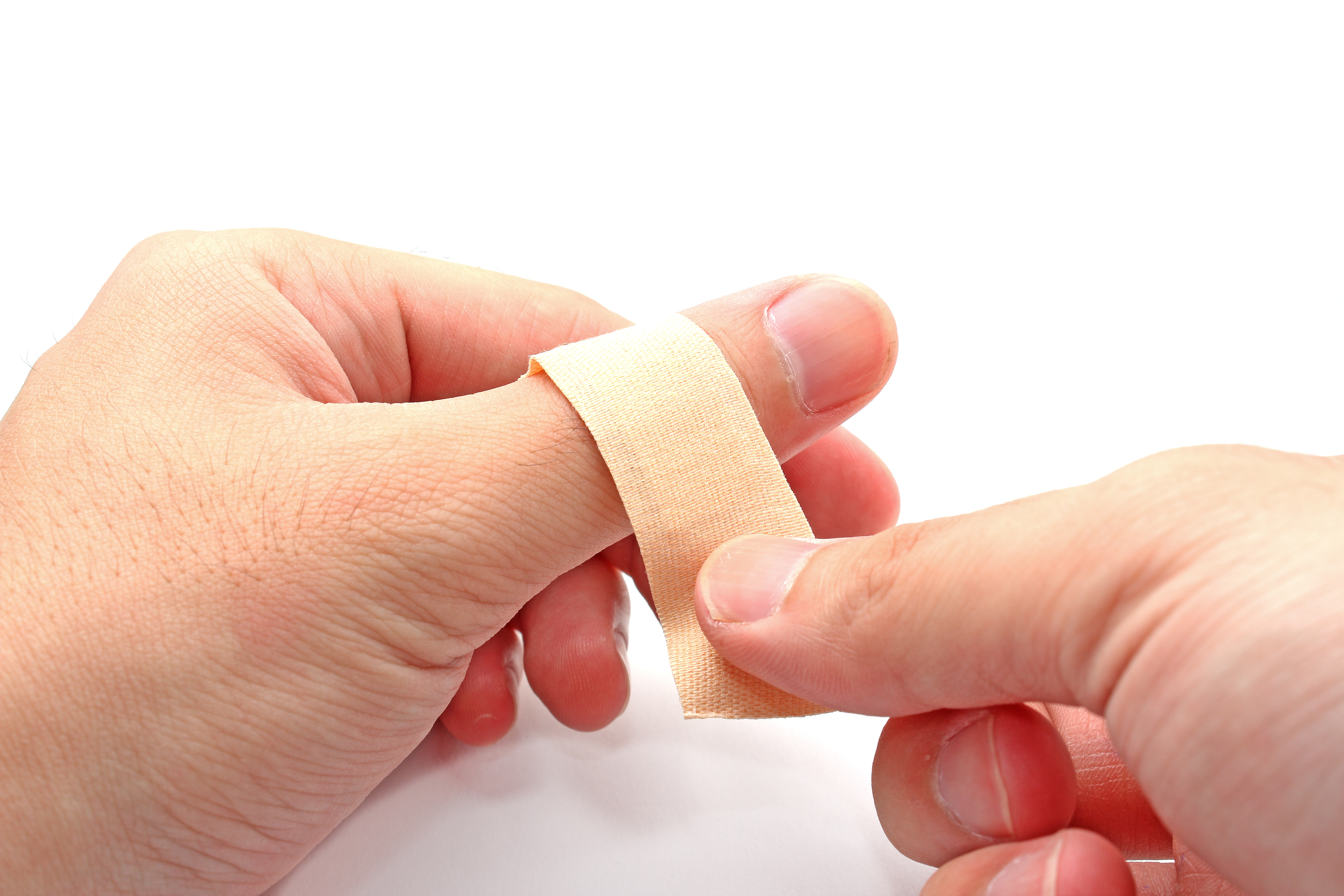 Cara Mengobati Luka, Serta Rekomendasi Obat Luka di Apotek