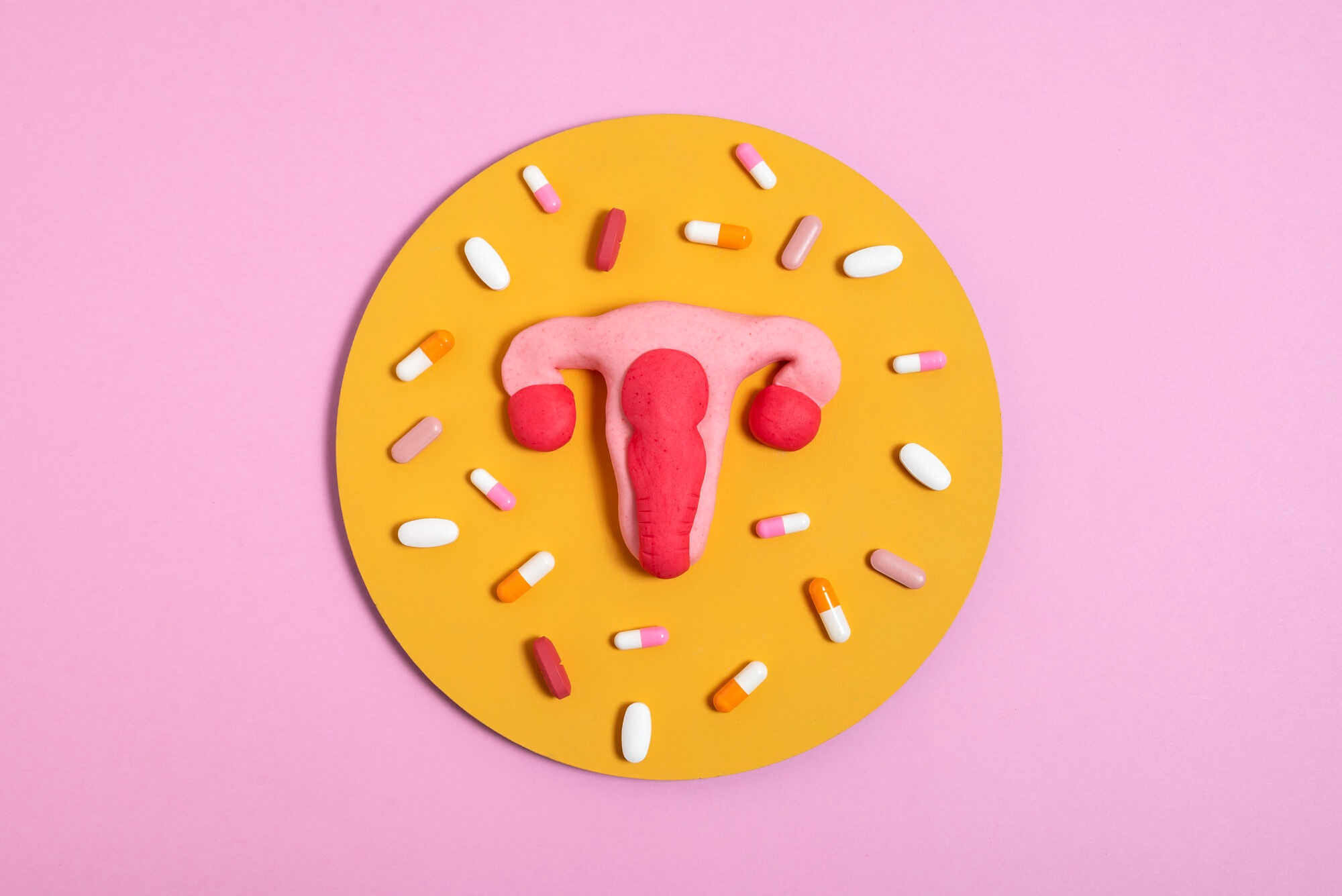 Cara Membesarkan Sel Telur bagi Pengidap PCOS