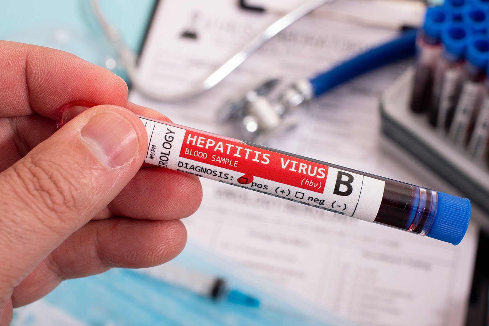Mengenal Gejala dan Upaya Pencegahan Hepatitis B