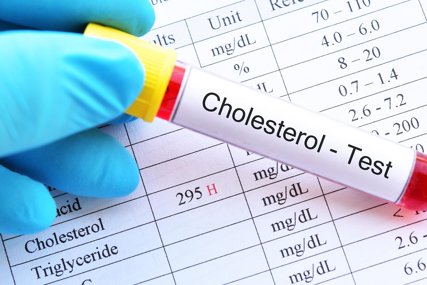 Tips Menurunkan Kolesterol Tinggi | Lifepack.id
