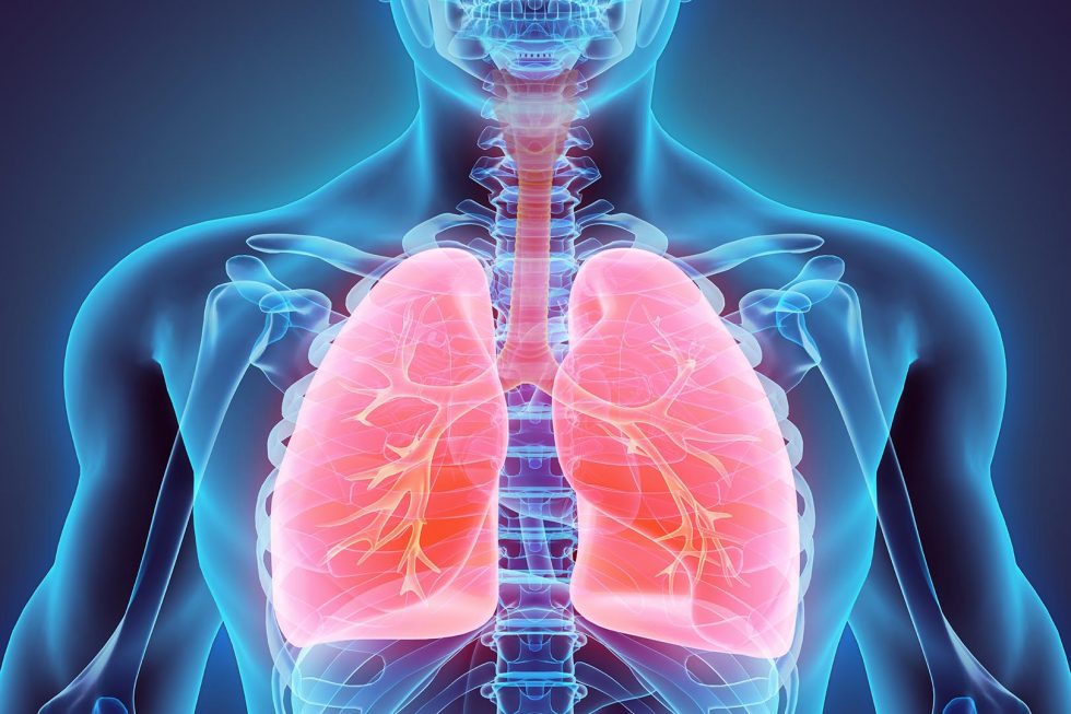 penyebab paru paru berair