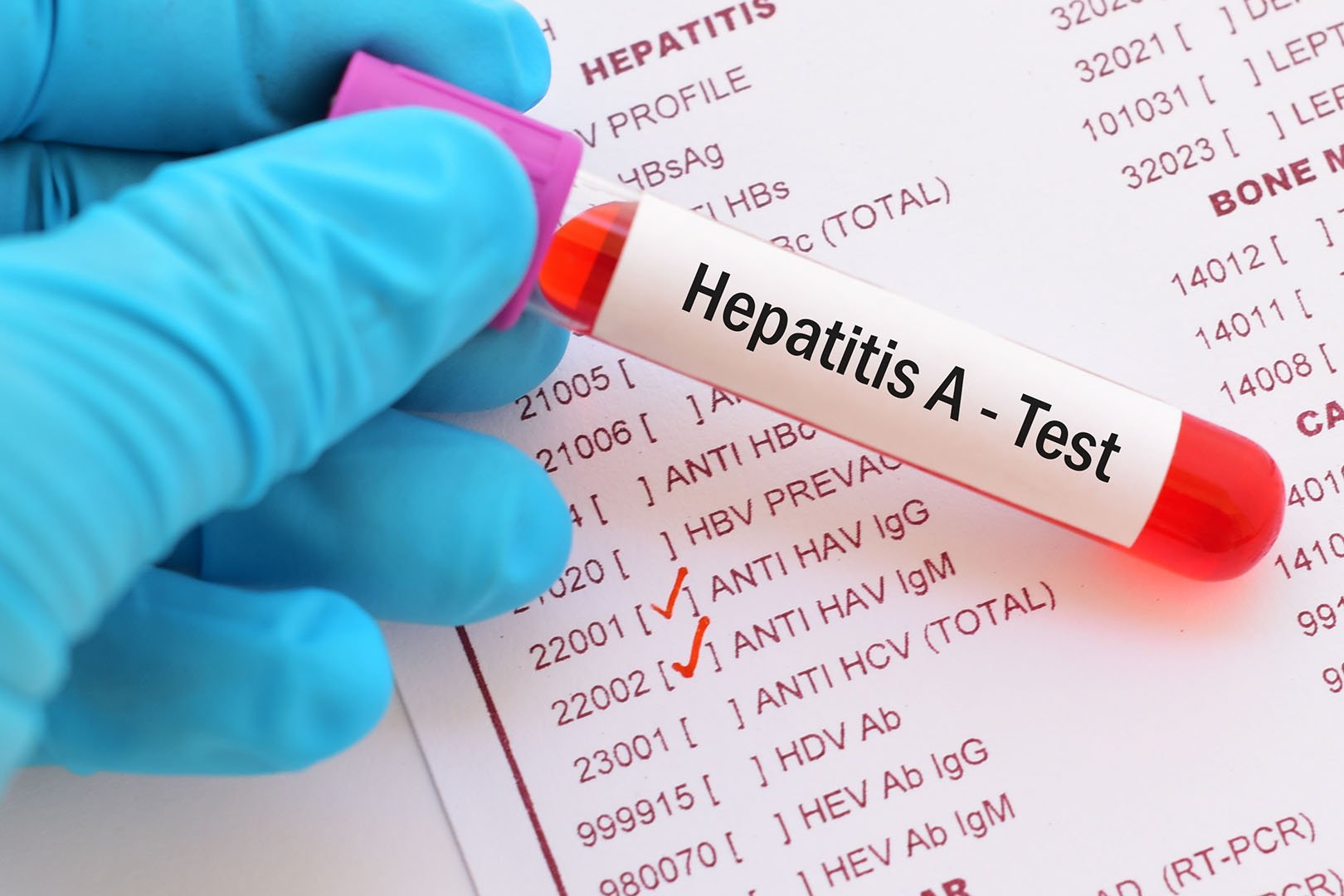 Apa Yang Harus Anda Ketahui Dari Penyakit Hepatitis A