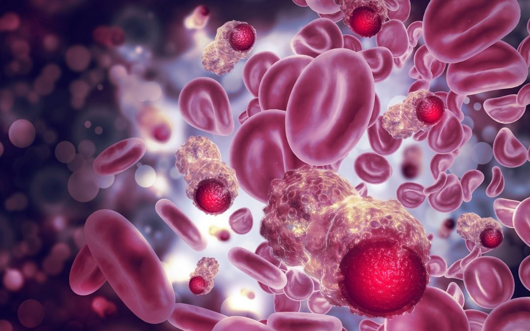 Kanker Darah (Leukemia)