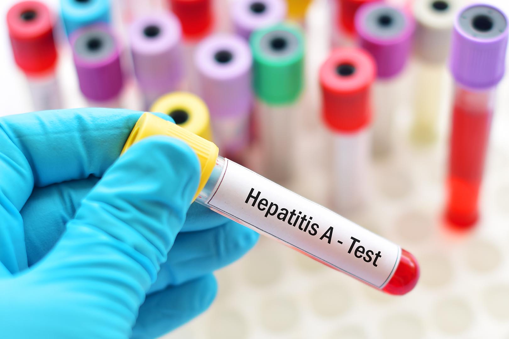 gejala-penyakit-hepatitis