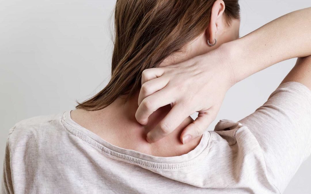 Kenali Ciri-Ciri Psoriasis, Penyakit Autoimun Pada Kulit