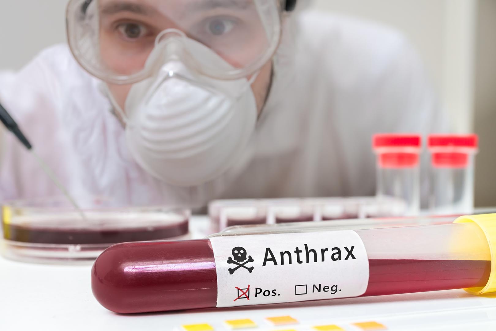 anthrax, penyakit anthrax