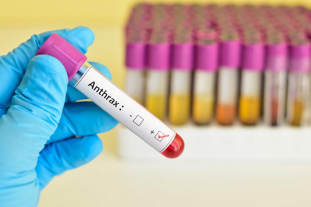 anthrax, penyakit anthrax