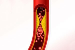 obat atorvastatin