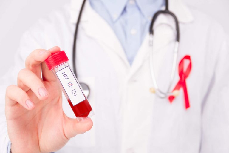 cara penularan hiv aids